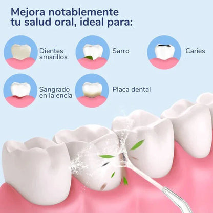 🚰💦 IRRIGADOR ORAL PORTÁTIL CON CHORRO A PRESIÓN 💦🚰